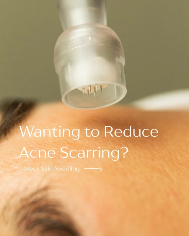 A look into how one of our most loved treatments works 🤍