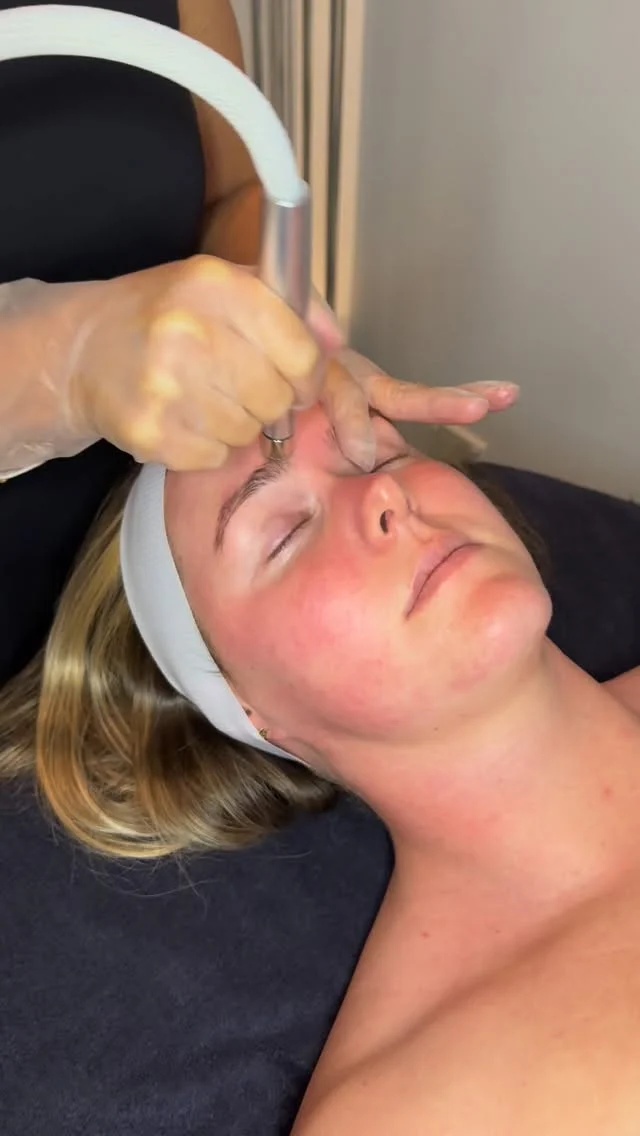 Mid week Microdermabrasion 🧖‍♀️ The ultimate exfoliation.